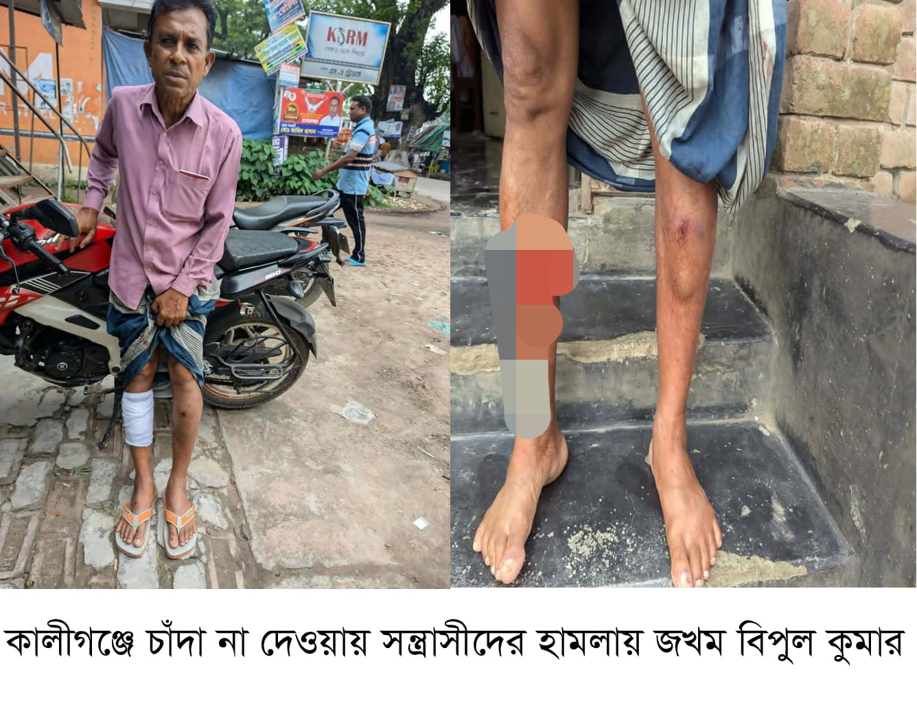 কালীগঞ্জে চাঁদা না পেয়ে সংখ্যালঘু সম্প্রদায়ের এক ব্যাক্তিকে কুপিয়ে জখম, থানায় মামলা